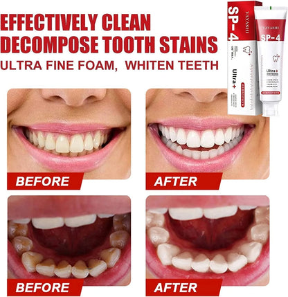 BrightenUp™ - SP-4 Ultra+ Teeth Whitening Toothpaste ✨🦷