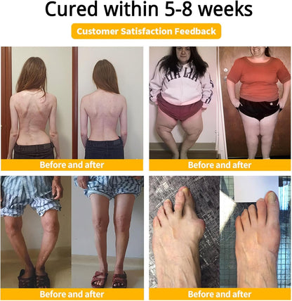 BeeFlex™ - Bee-Venom Pain-Relief Bone Healing Cream 🐝✨(Buy 1 Get 1 Free🔥🔥)